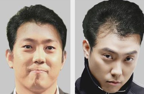 Eun Ji Won is in danger of going bald?